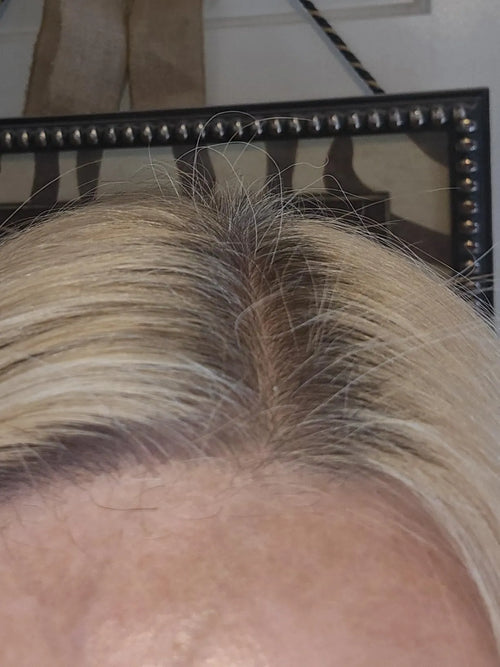 Real Hair Growrh Results in 30 days! Totally Worth It!